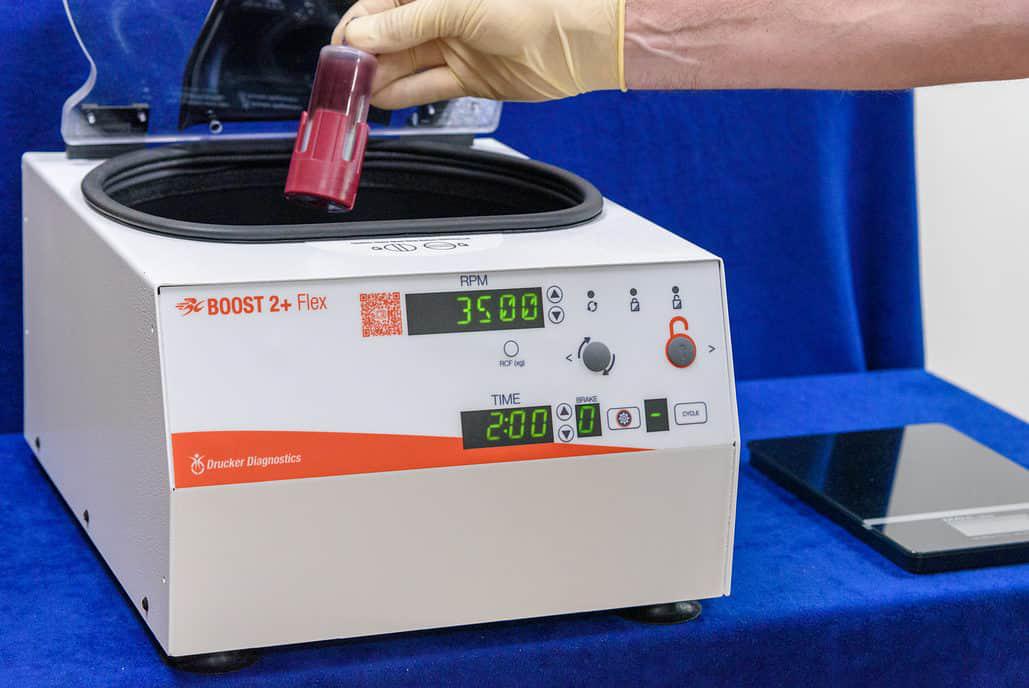 Centrifuge for PRP Therapy